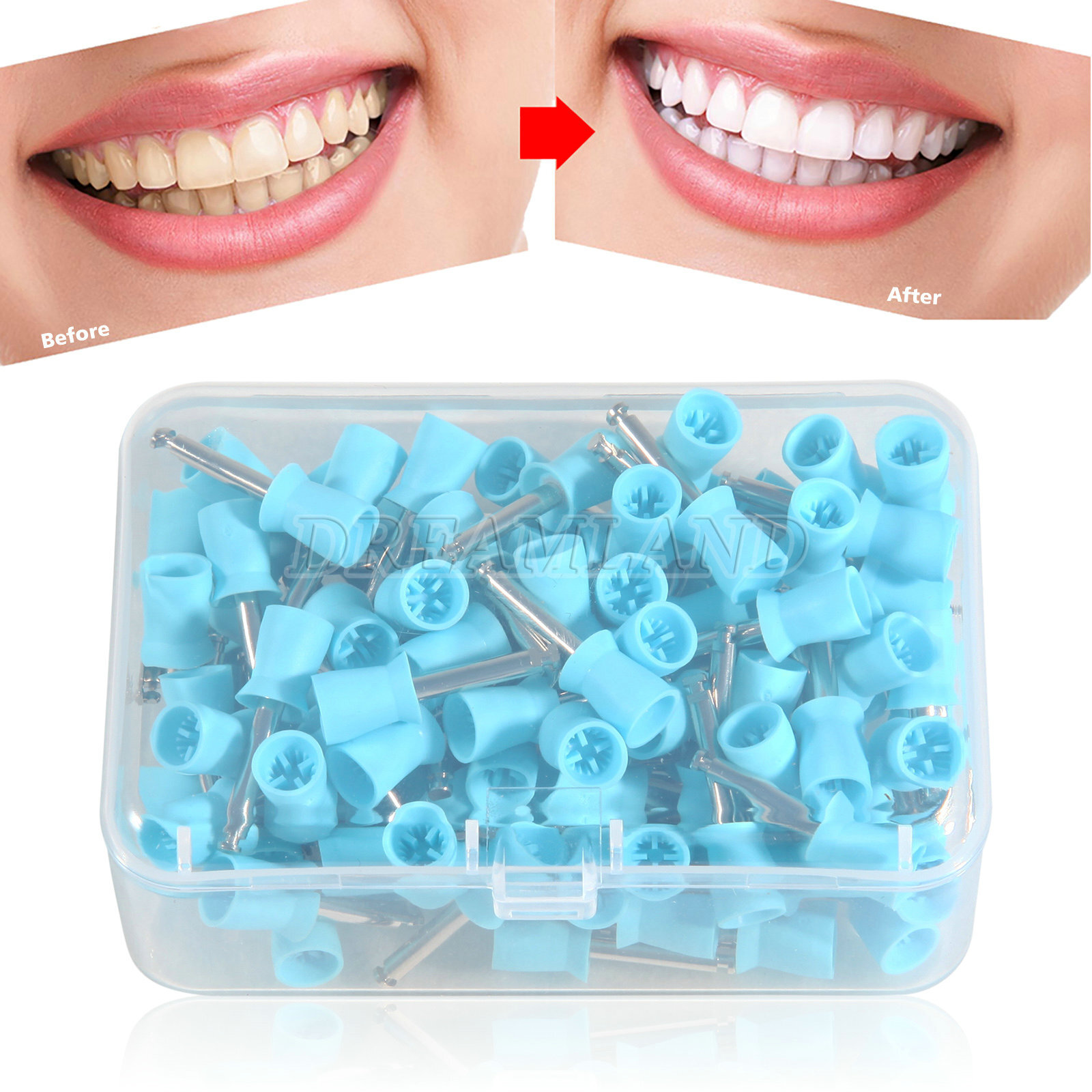 100 pcs Dental Polishing Polish Prophy Cups Latch Type Brushes Polisher cup Blue