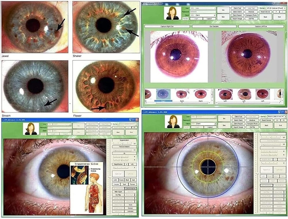 Analyzer Camera HD Iriscope Eye Camera with Analysis Software for Detailed Eye