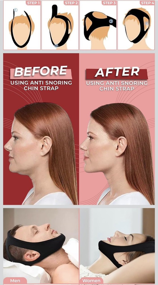 Adjustable Anti Snore Chin Strap - Effective Snoring Solution - Breathable CPAP
