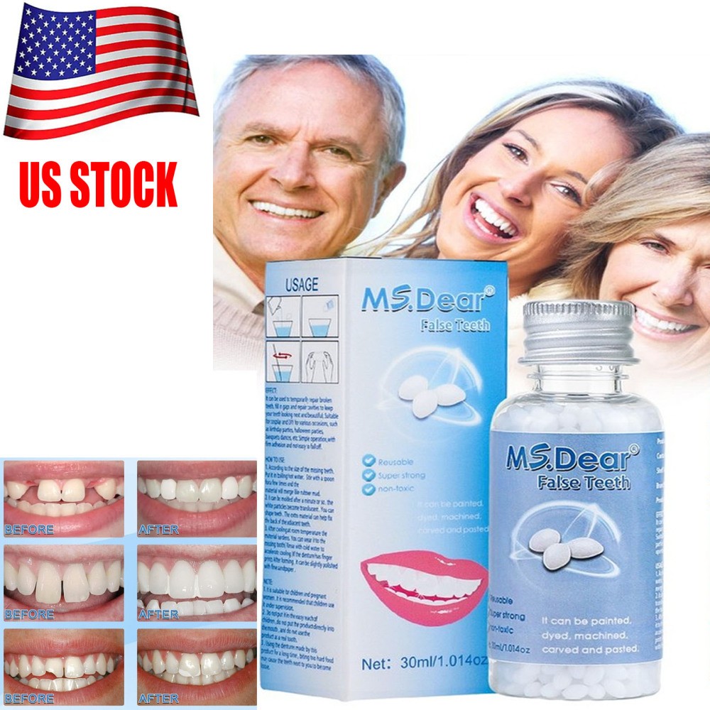 Moldable Teeth Beads Repair Kit - Temporary Fix for Missing, Broken or Gap Teeth