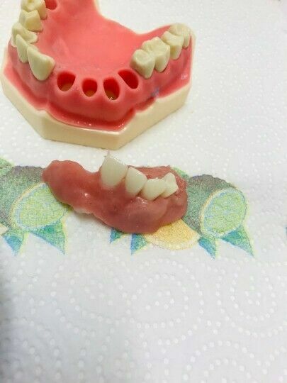 DIY Denture Kit Immediate Partial Denture, Full Denture Upper OR Lower NO MOLD