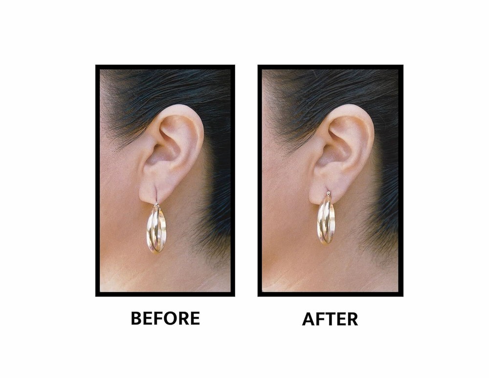 Lobe Wonder - The ORIGINAL Ear Support Patch for Pierced Ears -...