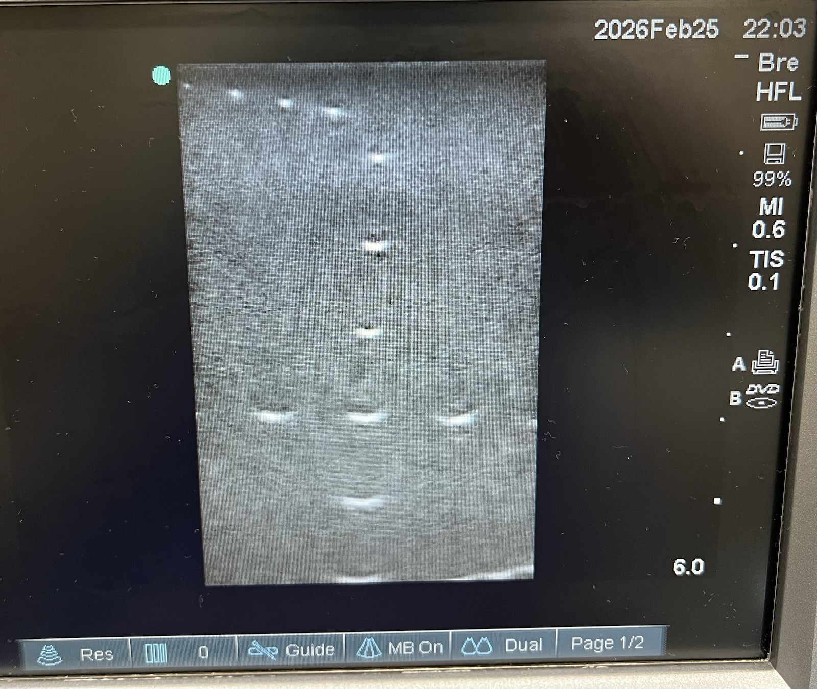 Sonosite HFL38X/13-6 MHz Ref P07682-70 (Parts Only)
