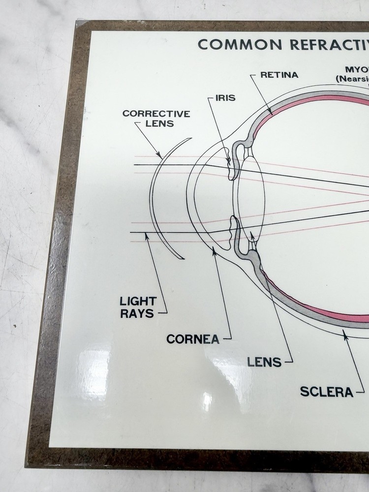 Vintage Optometry Eye Chart Board Common Refractive Errors Teaching Display