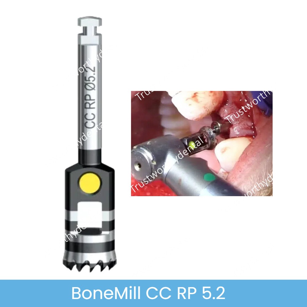 Dental Bone Mill with Guide Conical Connection NP RP WP Fit NobelReplace ACTIVE