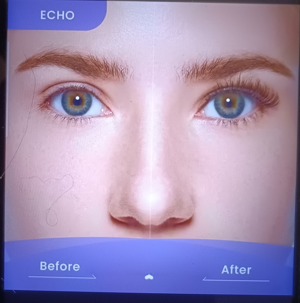 ISOPIA Iso-Gentle and ISOPIA Iso-Friendly