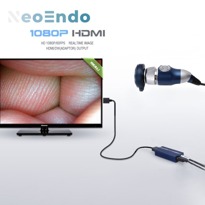 Medical Portable Endoscope Camera Full HD 1080P HDMI And USB Video Output