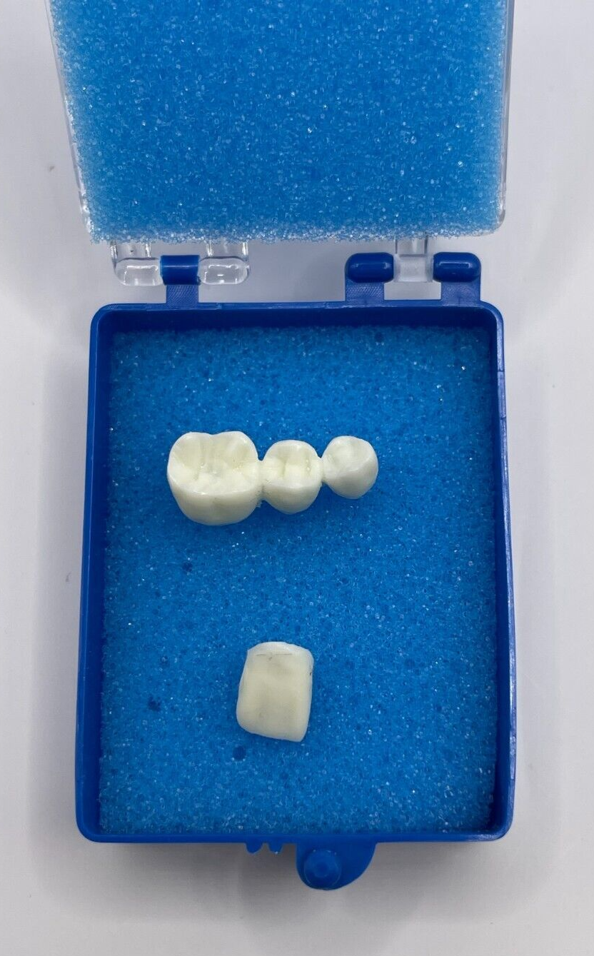 50 Pack, 2" Blue Crown Foam Case Container Hinged Display Box Jewelry Teeth