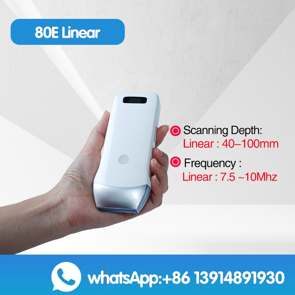 Portable Wireless Ultrasound linear Scanner Probe 80 element
