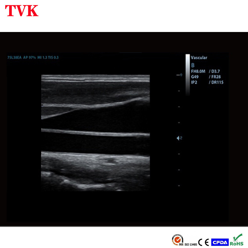 Mindray 75L38EB Linear Array Probe for DP-10, DP-20, DP-2200, Comatible Probe