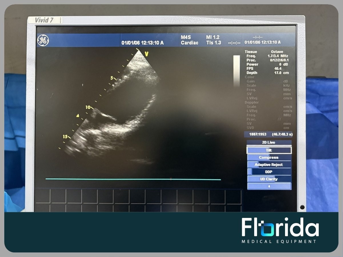 2007 GE M4S SECTOR ARRAY ULTRASOUND TRANSDUCER PROBE REF: 5129041 TESTED