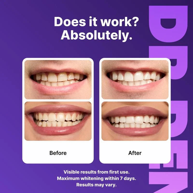 DR.DENT Purple Teeth Whitening Strips – Stain Removal with Whitening 42 strips