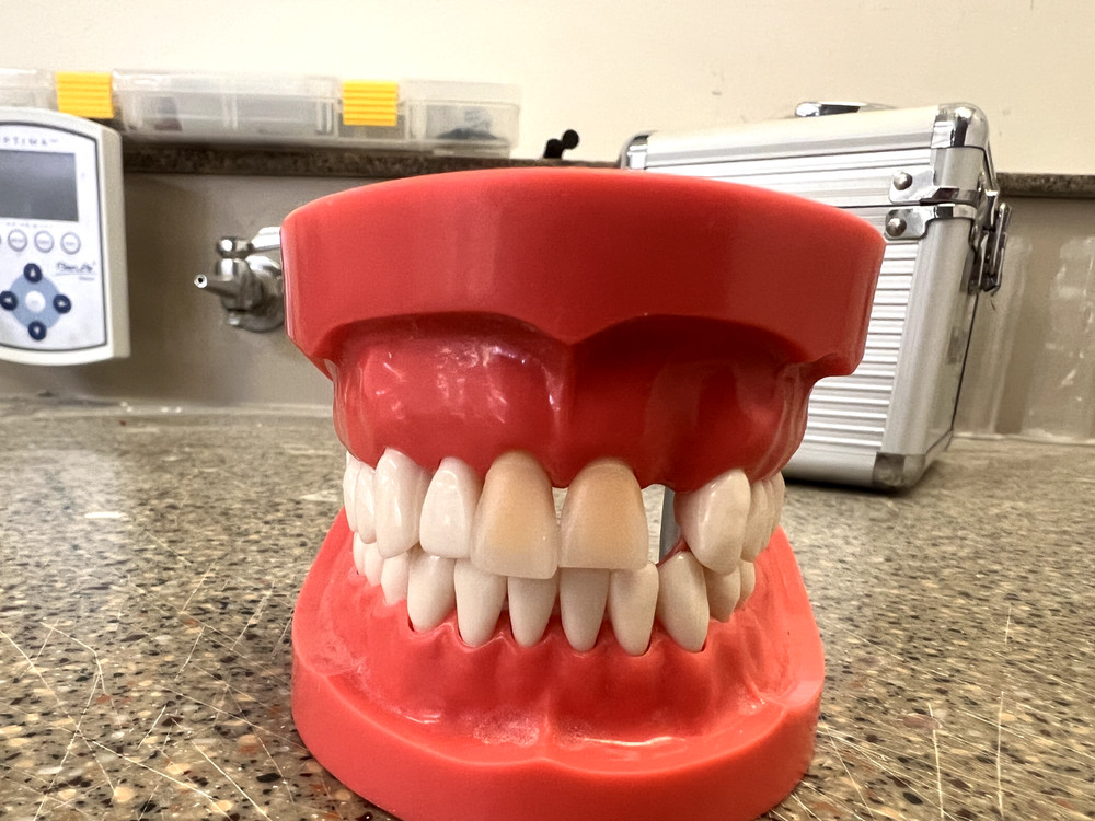 Kilgore MCG-1 Fixed Dentoform (Nissin Dental Model)