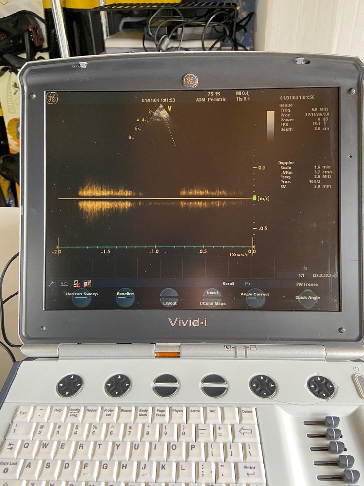Ge ultrasound probe 7srs