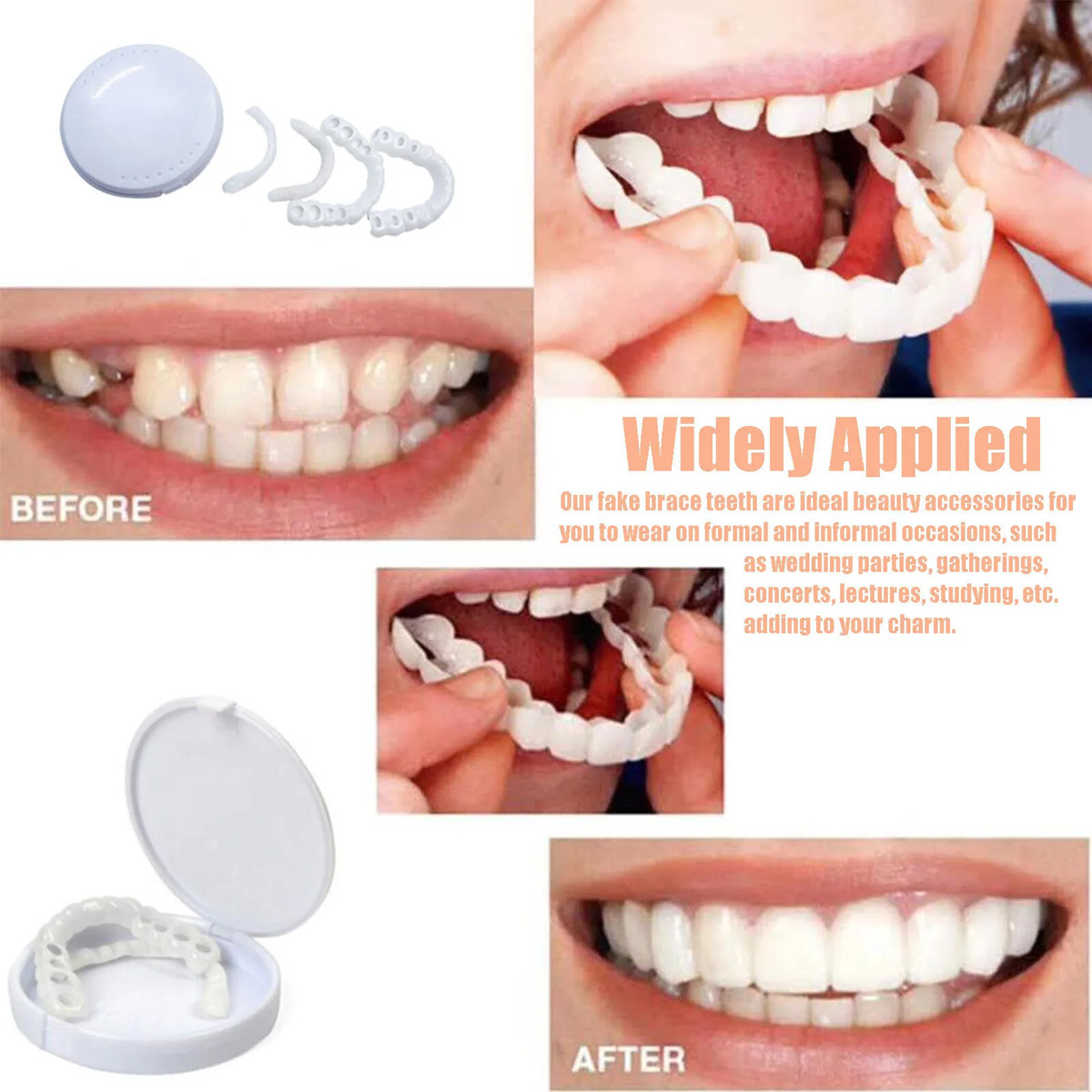 Smile Snap On Upper + Lower False Teeth Dental Veneers Denture Tooth Cover Set