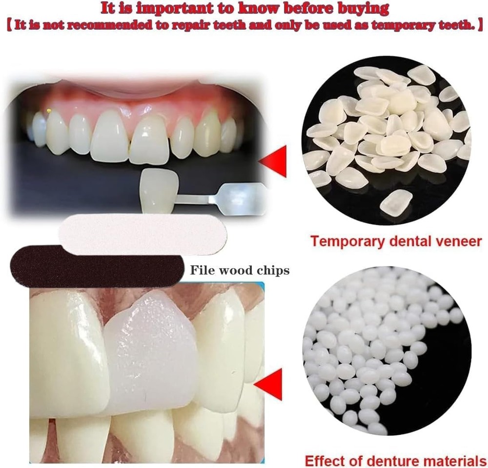 Instant Tooth Repair Solution: Moldable Granules for Missing Teeth Confidence