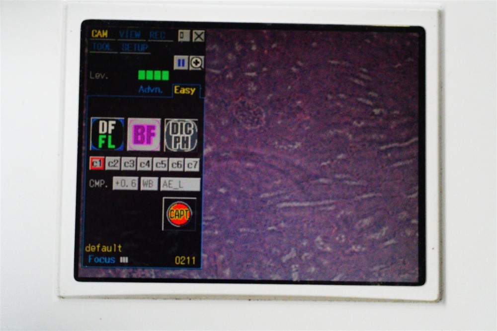 Nikon Digital Sight DS-L1 W Digital Sight DS-2Mv Camera Tested w Eclipse TS100