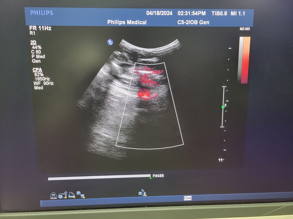 Philips C5-2 Broadband Curved Array Ultrasound Probe