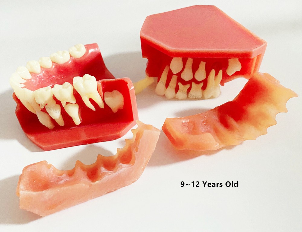 Dental Teaching Pediatric Teeth Children 9-12Years Old Permanent Alternate Model