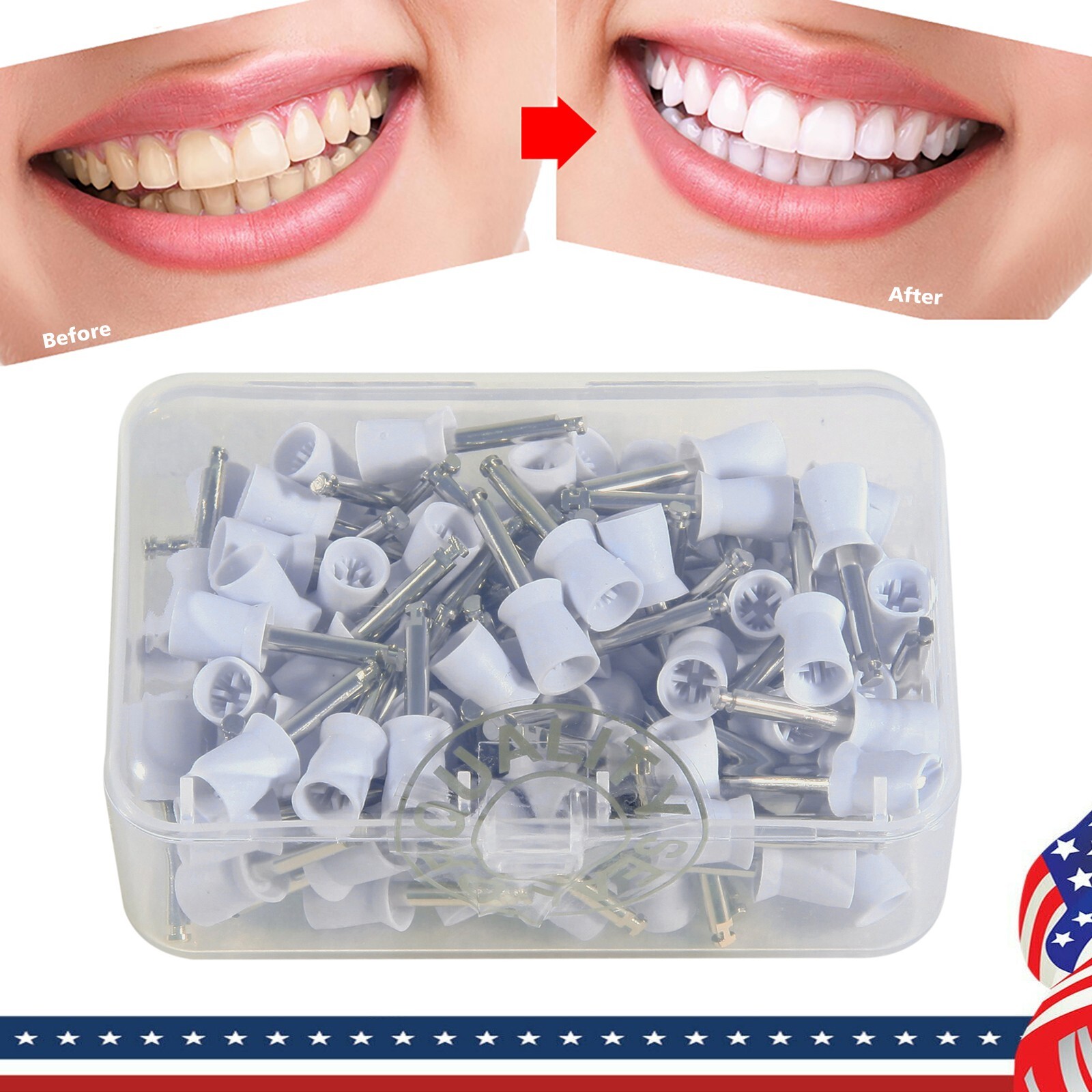 100Pcs Dental Rubber Prophy Teeth Polishing Cups Polish Latch Type Brushes White