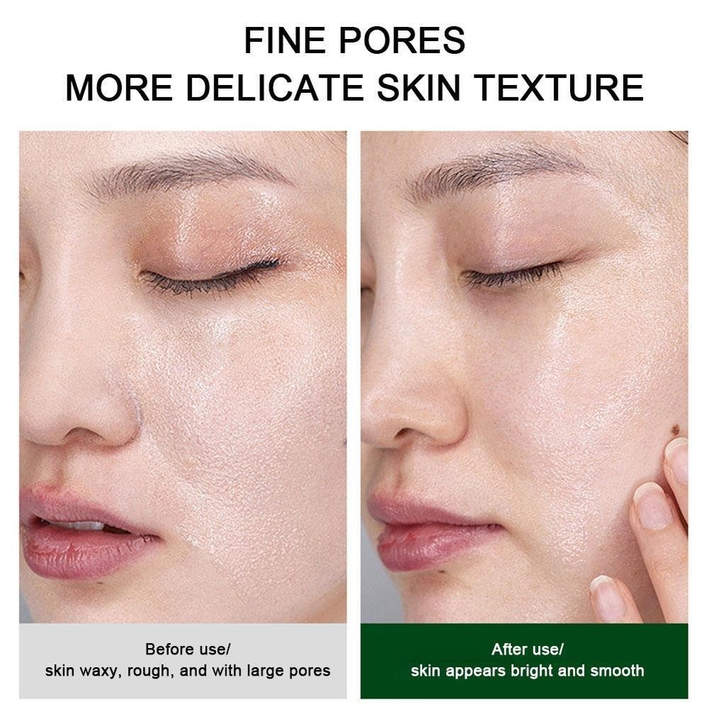 12pcs Bubble Face Sheet Masque Centella Asiatica Bubble OilControl|us~ B1C8