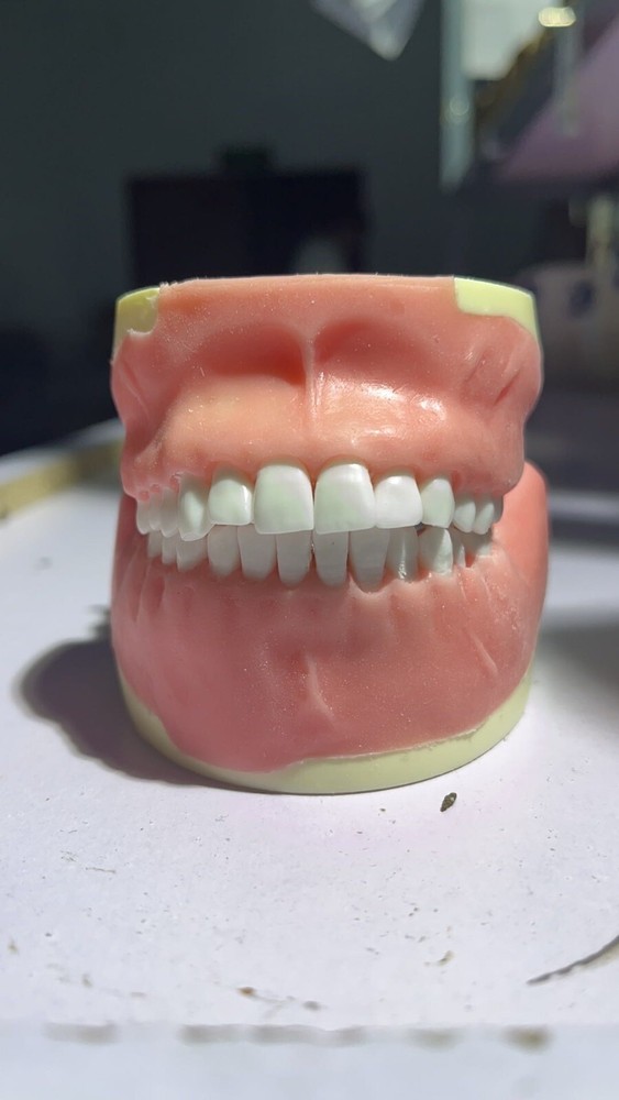 Maxillary+mandibular Tooth Extraction Practice Model Dental Typodont Teeth