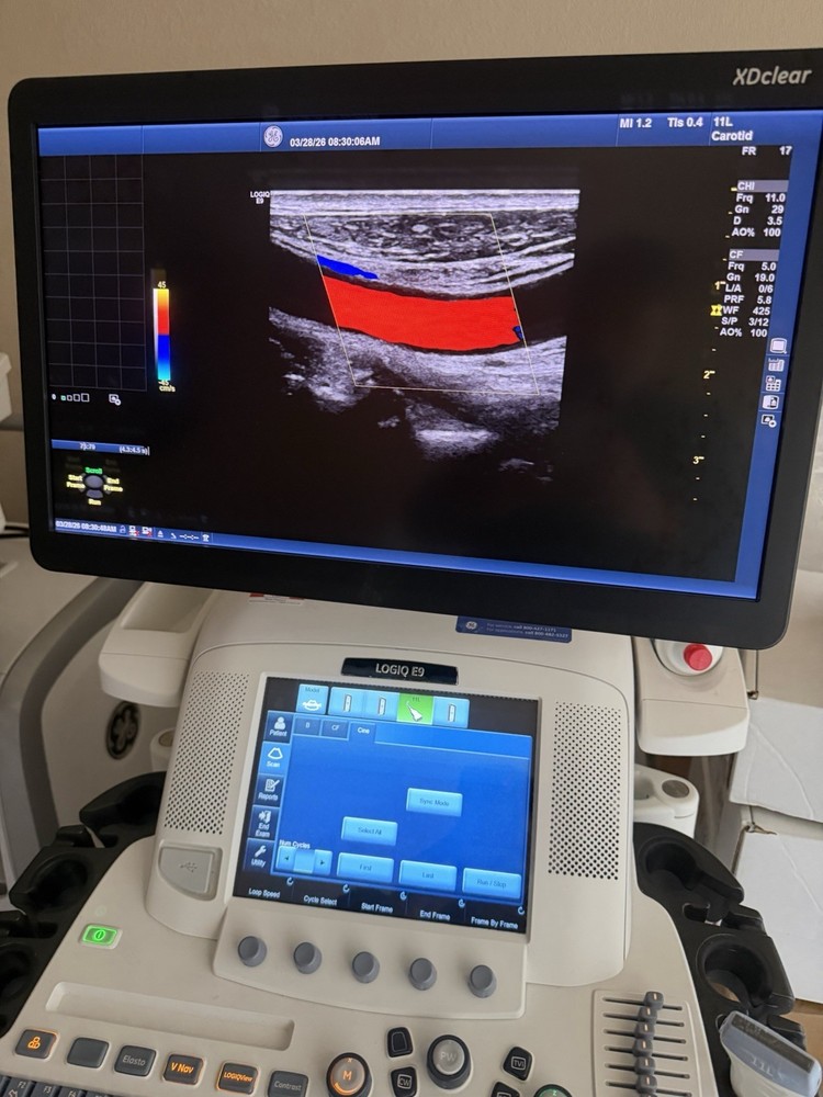 2017 GE 11 L D Probe Excellent working condition