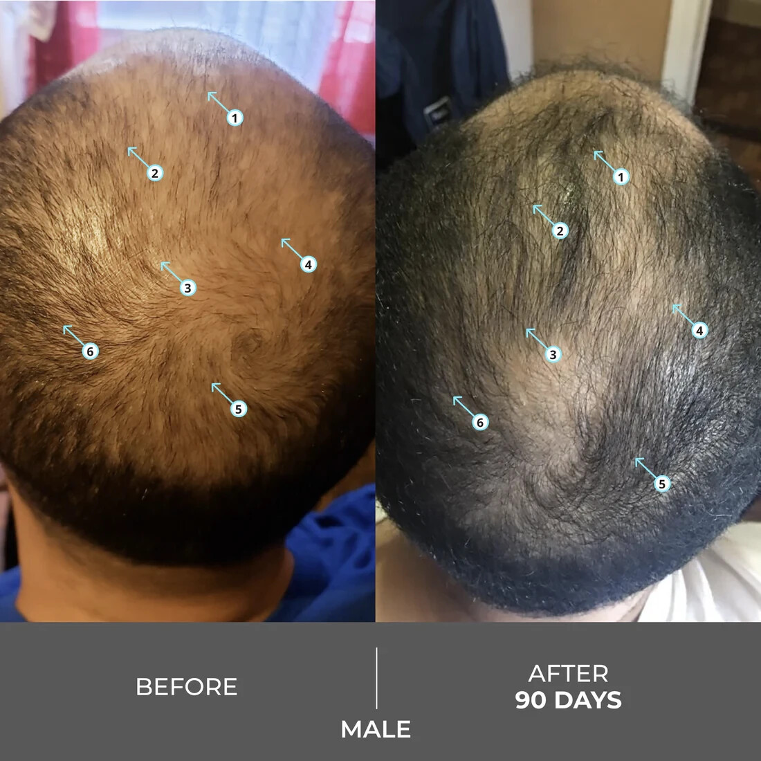 Revita Extra Strength Hair Density Shampoo for Hair Growth for Men and Women