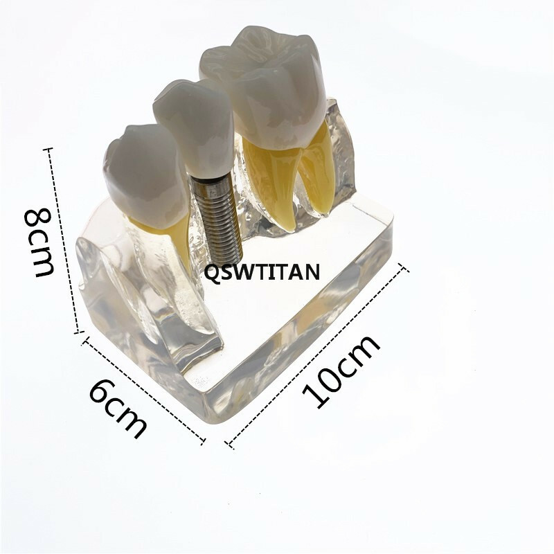 Dental Demonstration Study Teeth Model for Implant Analysis Crown Bridge Model
