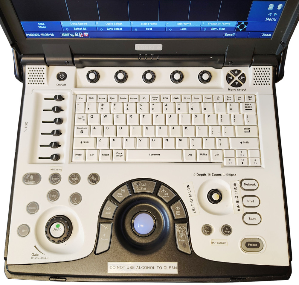 GE LOGIQ E Ultrasound System