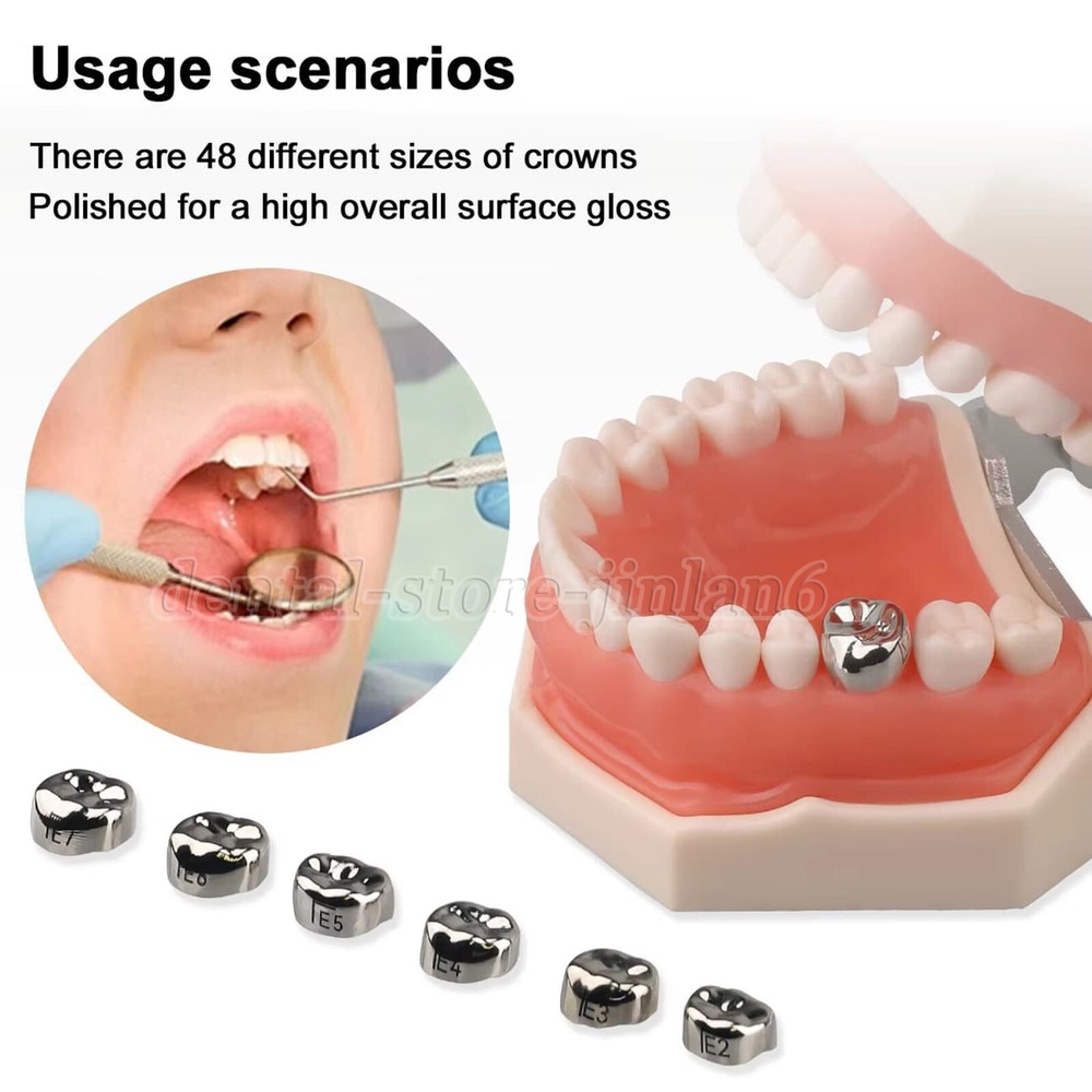 48 ASSORTED PRIMARY MOLAR STAINLESS STEEL CROWNS - COMPLETE KIT