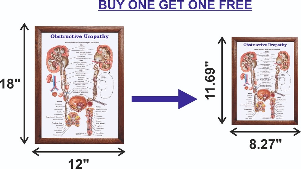 Obstructive Uropathy Chart 12x18 inches