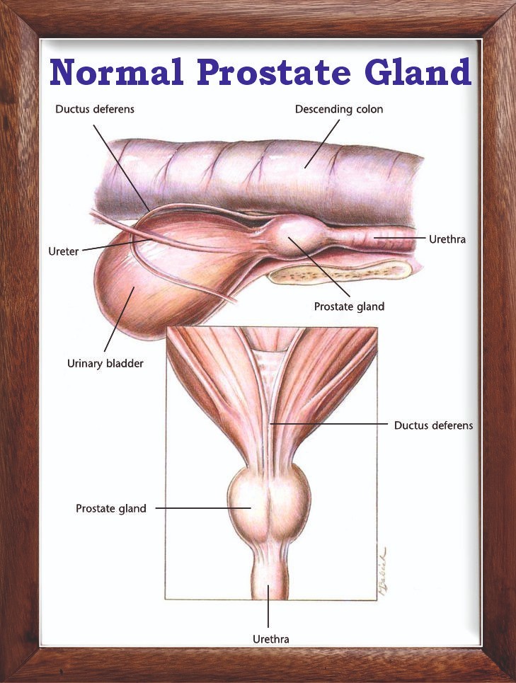 Normal Prostate Gland Chart 12x18 inches