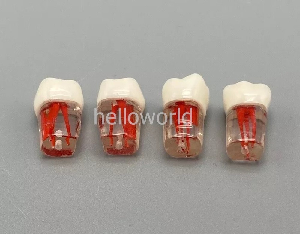 Dental Root Canal Teeth Study Practice Model Endodontic RCT Endo Pulp File 5pcs