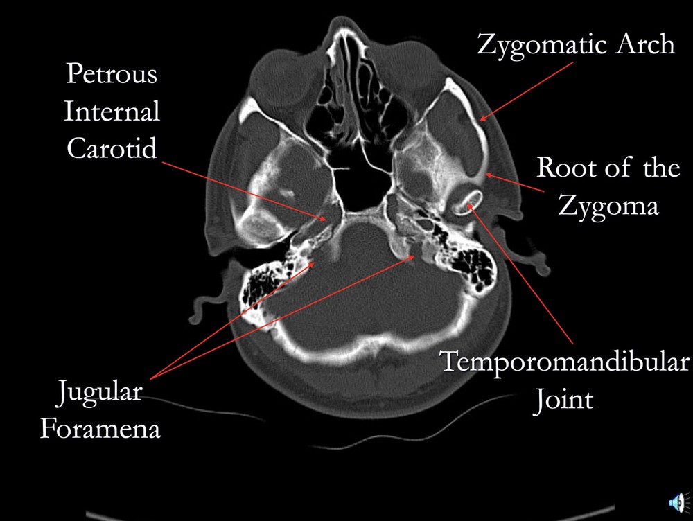 NEUROSURGICAL Basics Audio CD + 248 Page PowerPoint CD