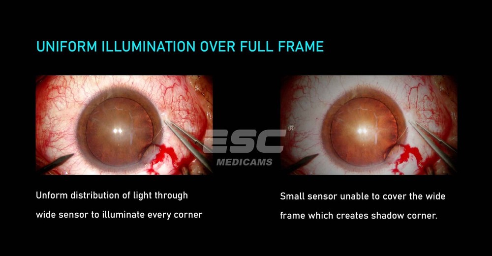 4k Microscope Camera for Surgical Operating Zeiss Beam Splitter C-Mount Adapter