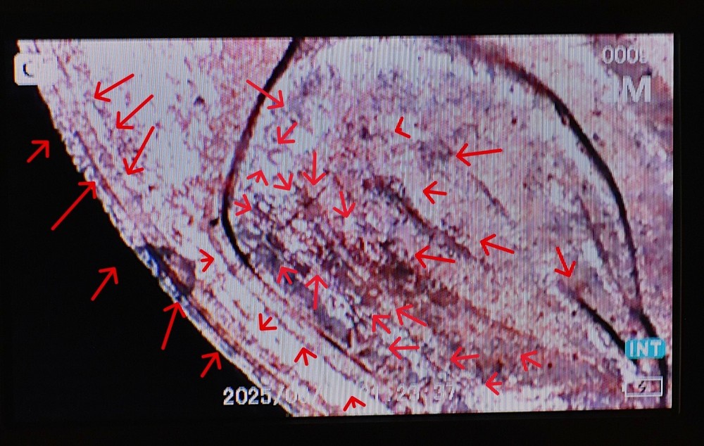2001 Penny Multi Strike Error Double Die, Die Cracks, Initials Obscured