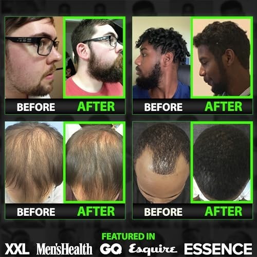 Beard Growth Serum - GROW Maximum XXL Beard Growth Oil for Men -Thickens & Fills