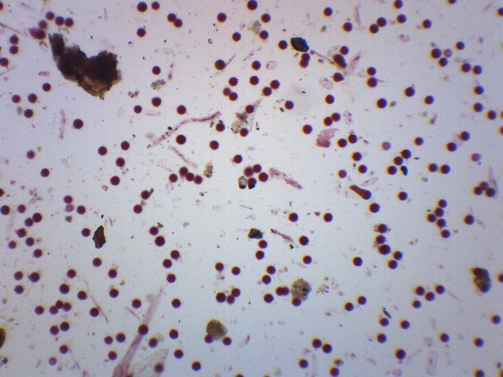 Dicot Pollens - Prepared Microscope Slide - 75x25mm - Eisco Labs