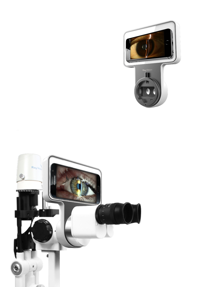 Phonto Imaging Optic System Apple Slit lamp Adapter Android Smart Phone Adaptor