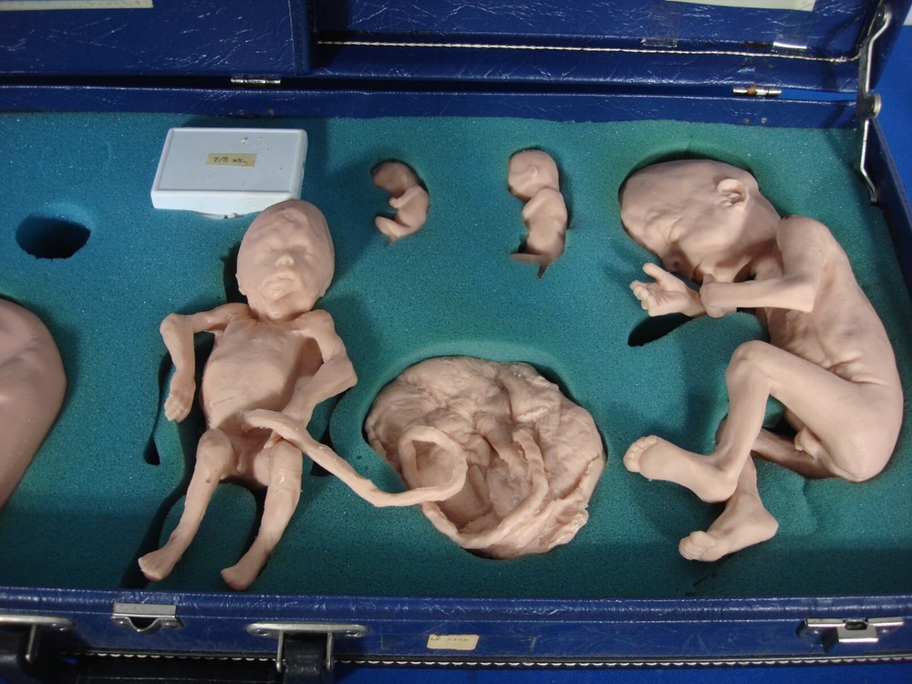 Vintage Trainex Fetal Development Trainer