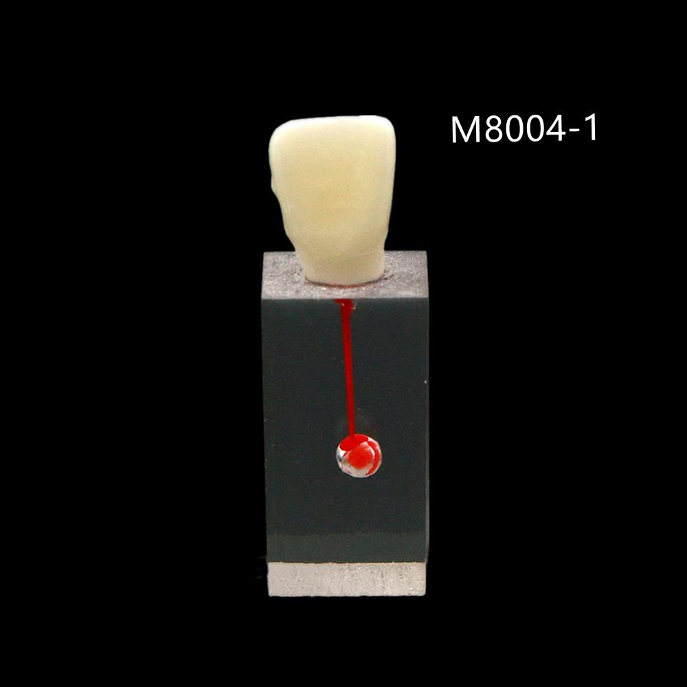 Dental Resin Training Study Endo Root Canal Teeth Model Practice Block RCT Pulp