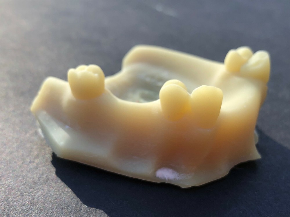 ALPHASENSE 3D DENTAL MODEL RESIN (500 ML)