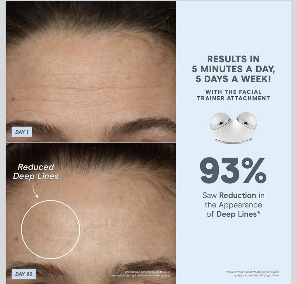 NuFACE Trinity Plus Microcurrent Facial Toning Device
