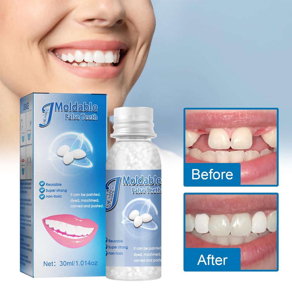 Tooth Repair Granules Temporary Kit Fitting Beads Reusable Moldable False Teeth