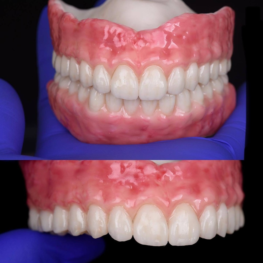 DLP SLA LCD 3d printer temporary teeth resin ..