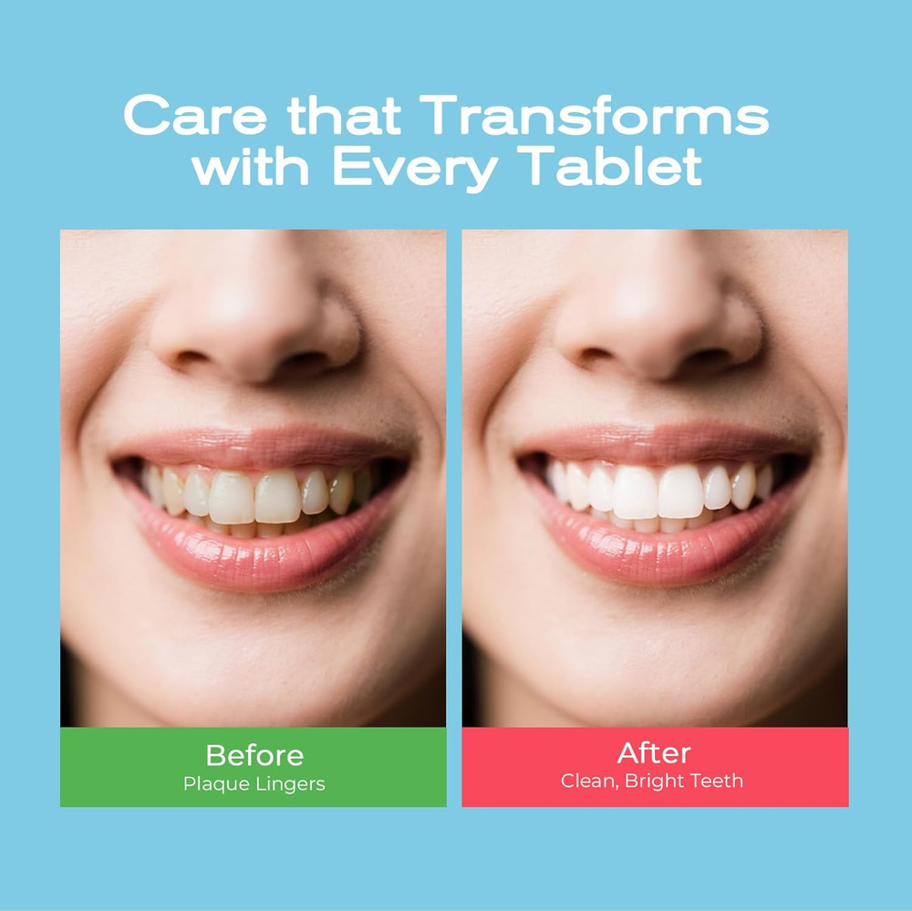 Whitening Toothpaste Tablets – Remineralizing Nano Hydroxyapatite Chewable Tooth