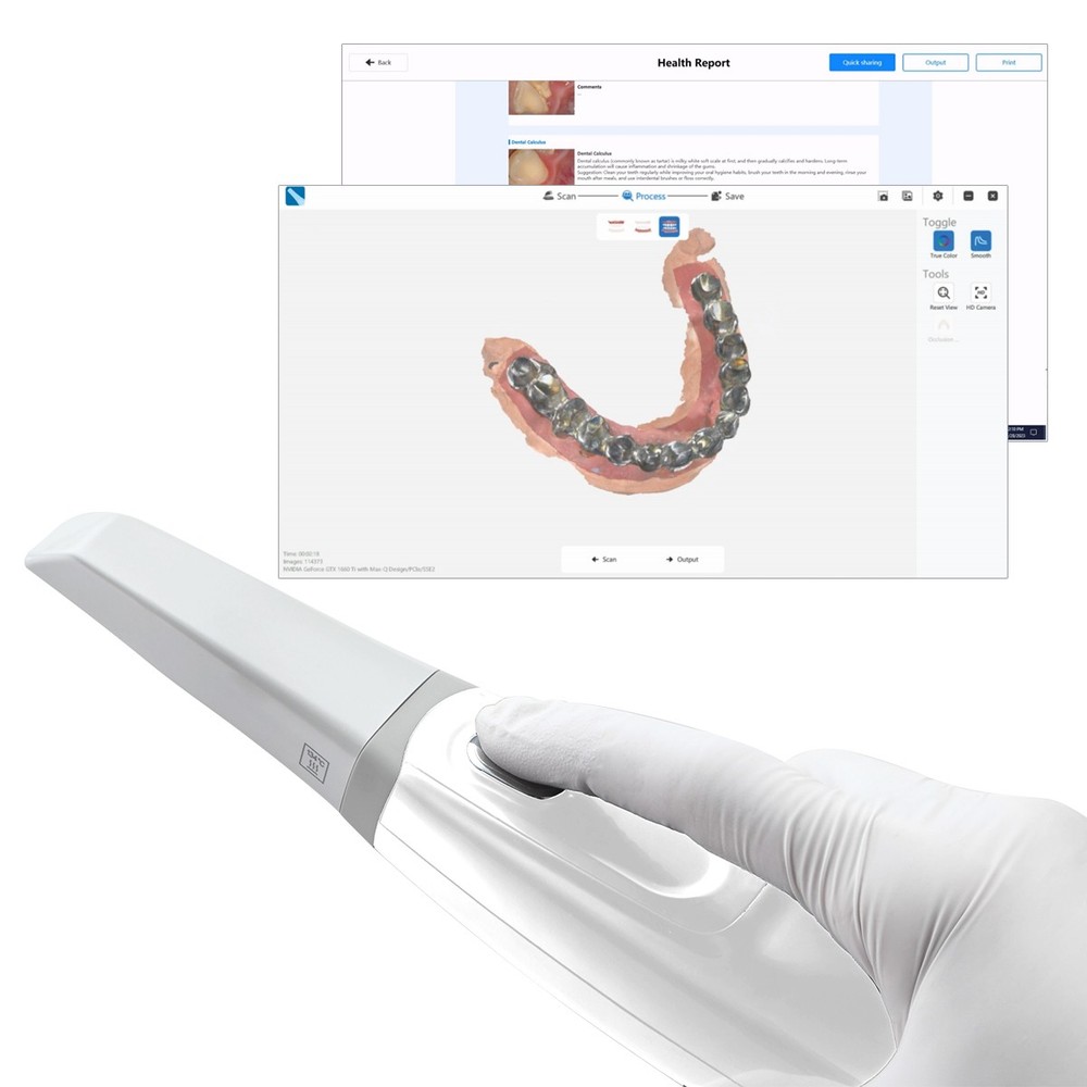 Dental Intra-oral 3D Scanner with Scanning Software
