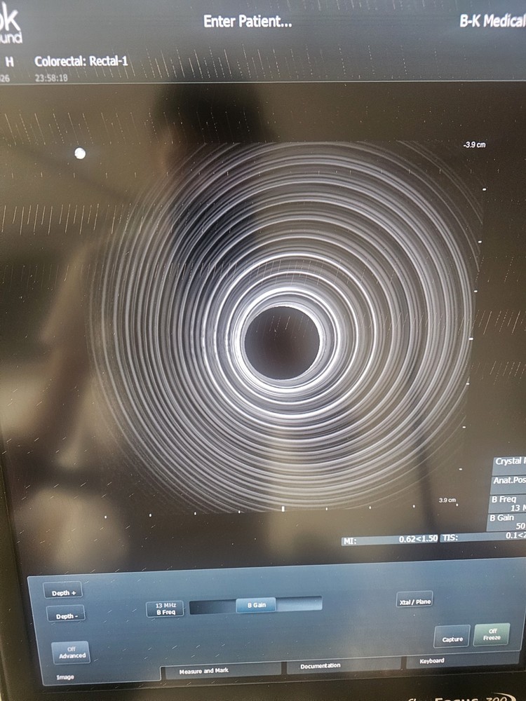 Bk Medical Type 2052 Transrectal Prostate Imaging Transducer Probe