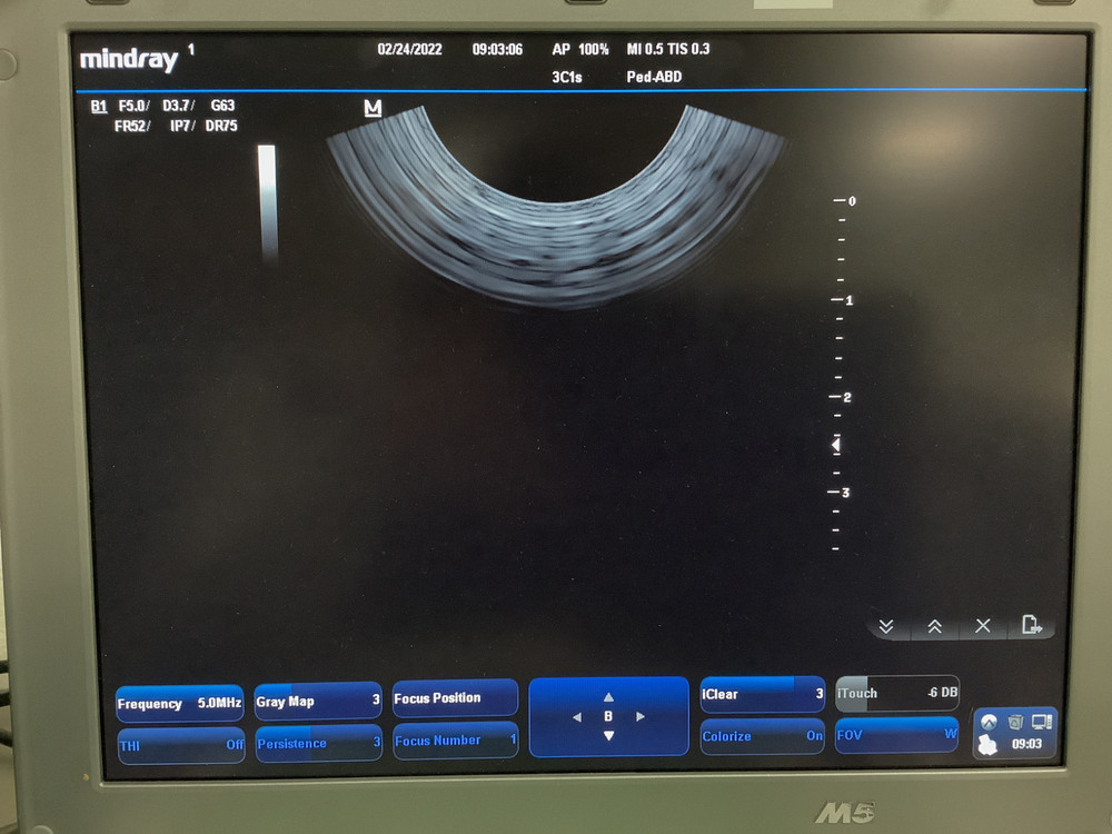 Mindray 3C1s Convex Array Ultrasound Probe